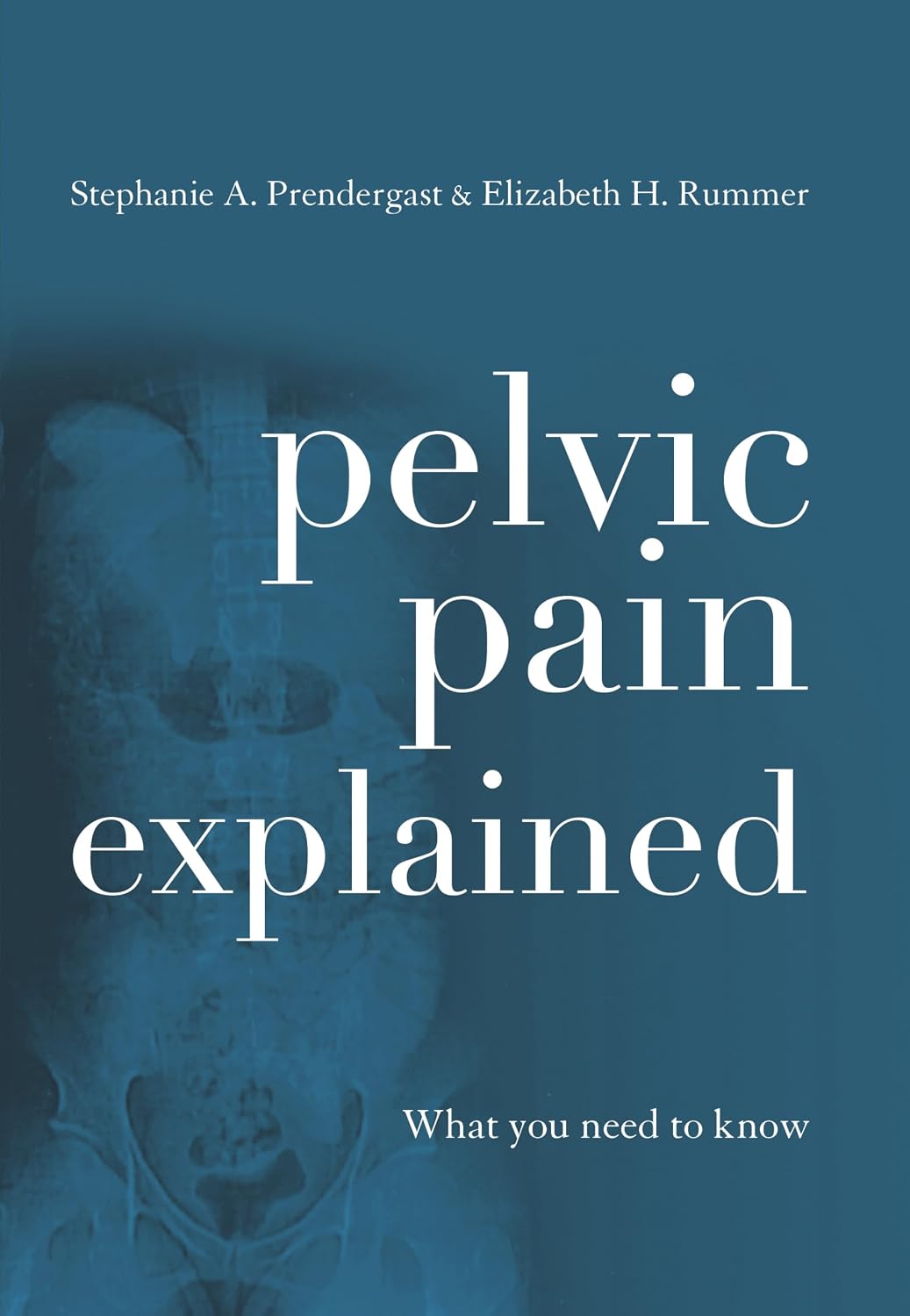 "Pelvic Pain Explained: What You Need to Know" by Stephanie A. Prendergast & Elizabeth H. Akincilar